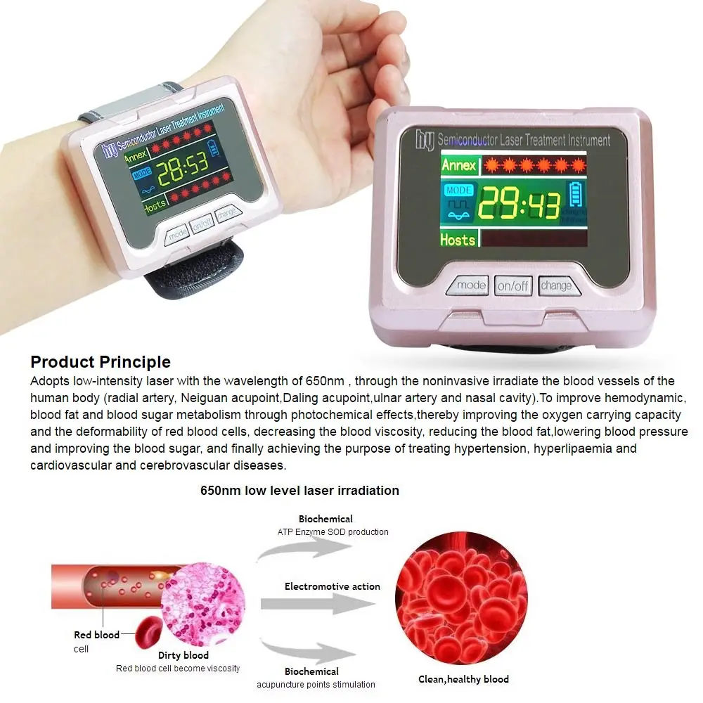 Наручные часы для лазерной терапии Нм | Красота и здоровье