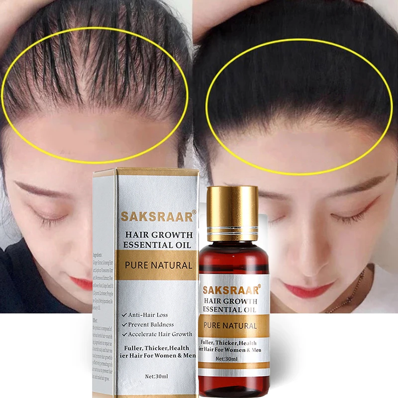 2pcs Hair Growth Essential Oils Essence Original Authentic 100% Hair Loss Liquid Health Care Beauty Dense Hair Growth Serum Care
