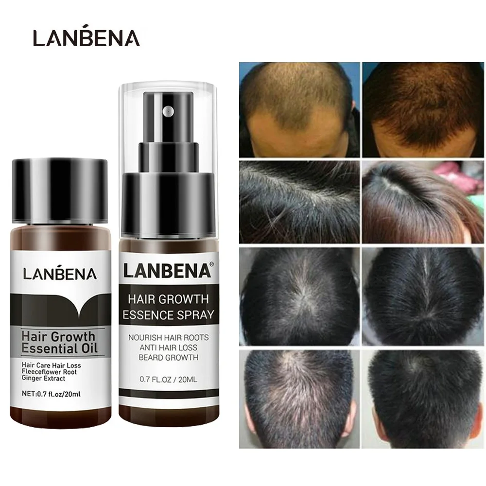 2 шт. эссенция для роста волос и предотвращения облысения|Средства от выпадения