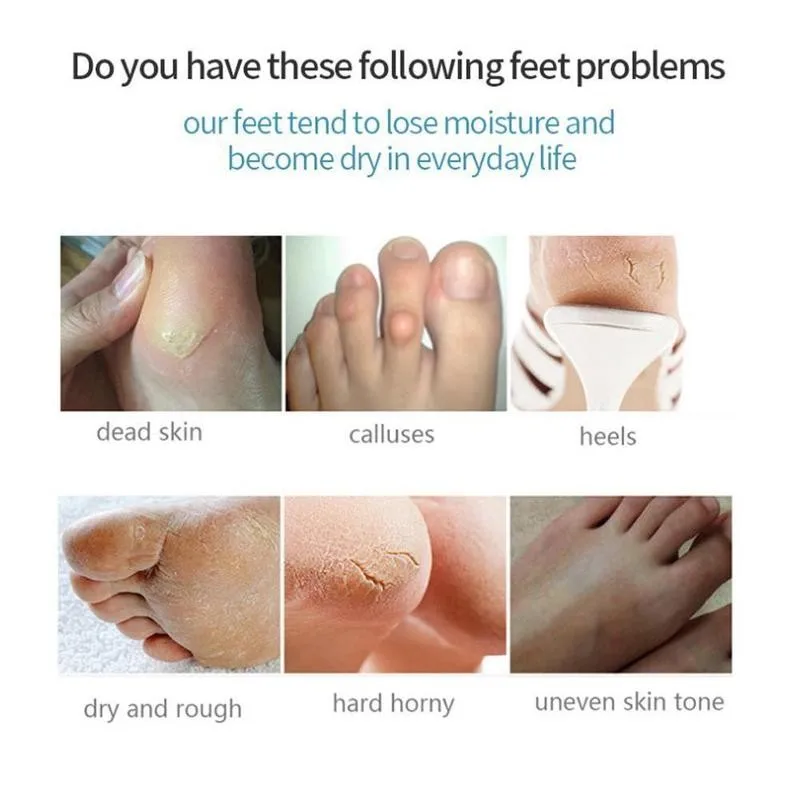 

1pair Feet Exfoliating Foot Milk Mask Exfoliating Improving Moisturizing Mild Cream Soothing Foot Foot Dryness Mask Z7V2