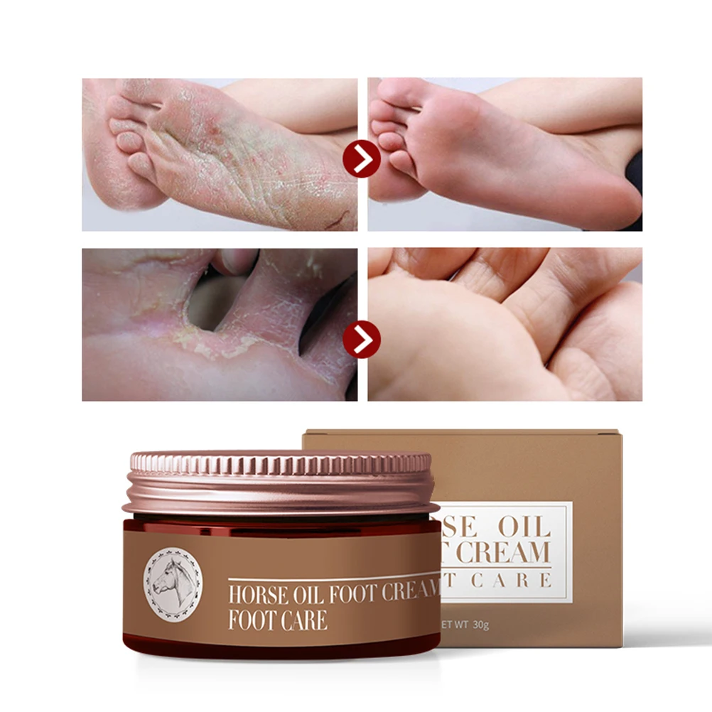 Крем для ног с конским маслом увлажняющий крем восстановления зуда снятие кожи и