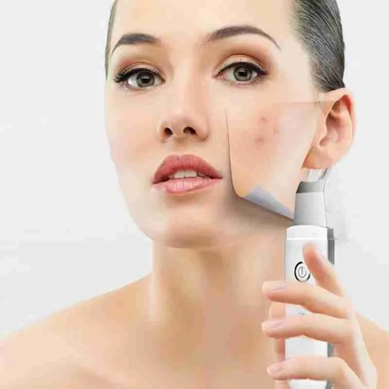 

Skin Scrubber Cleaner Ion Acne Blackhead Remover Peeling Shovel Cleaner Massager Face Lift Machine
