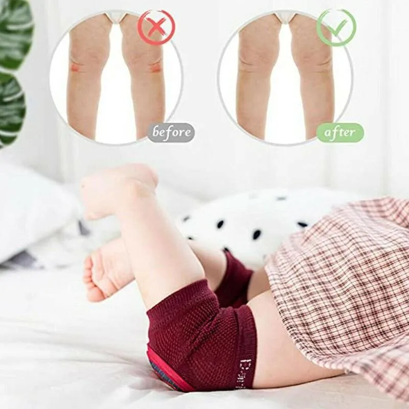 

Baby Crawling Knee Pad Infant Toddler Kneepads Protector Kids Breathable For Crawling Warmers Protective Leg Equipment Walk
