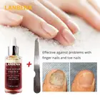 Эссенция для восстановления ногтей LANBENA, 12 мл, сыворотка для удаления онихомикоза, для дизайна ногтей, для осветления ногтей, эссенция для рук, TSLM1
