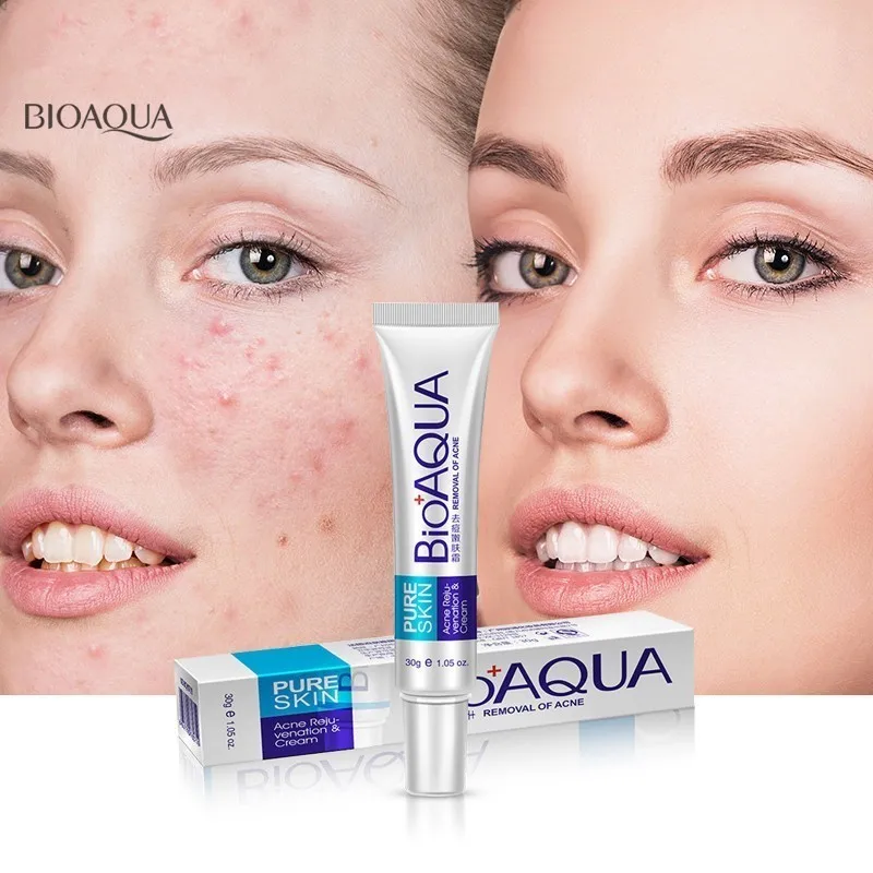 Bioaqua Face Cream Whitening Anti Acne Treatment Cream Oil Control Acne Scar Remover Pores Acne Moisturizing Cream Skin Care 30g