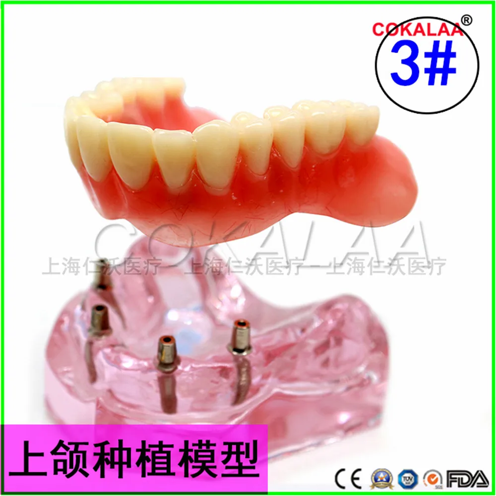 Модель верхней челюсти для зубных имплантатов с зубными протезами хорошего качества для обучения стоматологов.