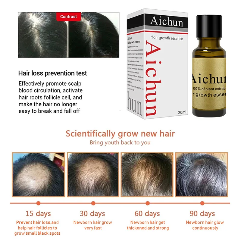 

20ml Powerful Hair Growth Essential Oil Treatment Preventing Hair Loss Care Products MH88