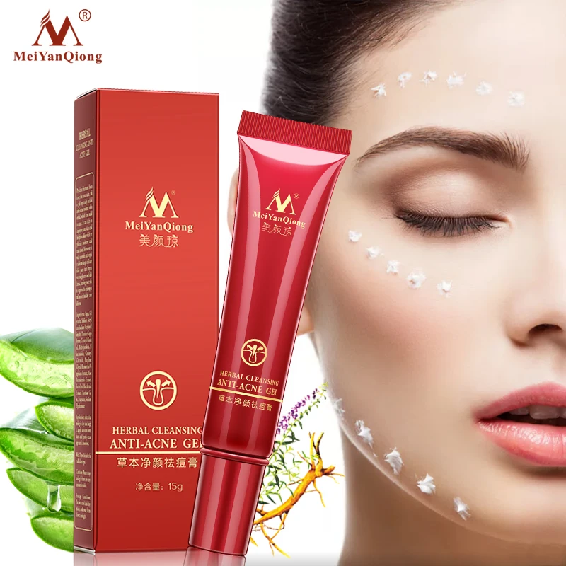 

High Quality Herbal Cleansing Face Anti acne treatment cream Herbal scar removal oily skin Acne Spots skin care face