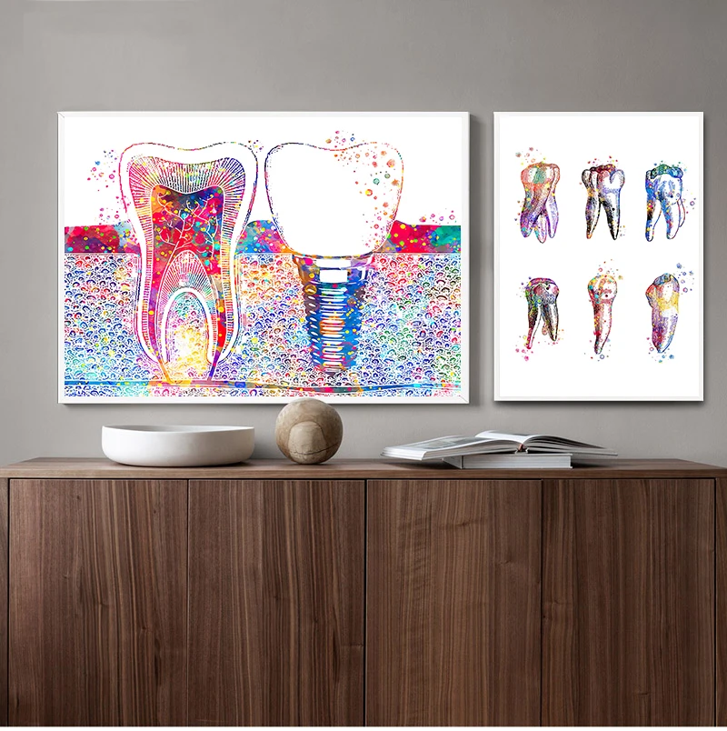 Картина для стоматологического искусства зубной имплантации холст печать