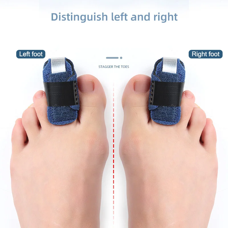 

1 шт., корректор для пальцев ног