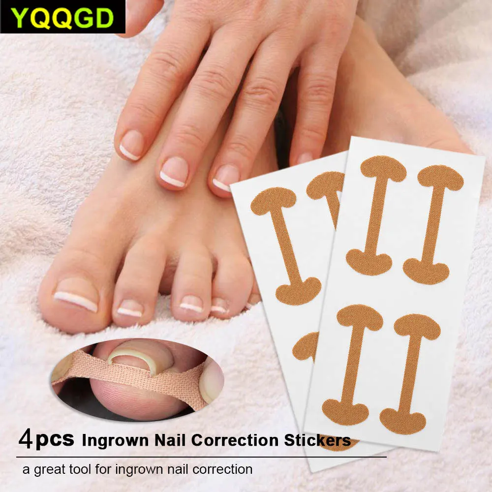 8 шт./компл. Уход за ногтями педикюрные инструменты корректор для ногтей наклейки