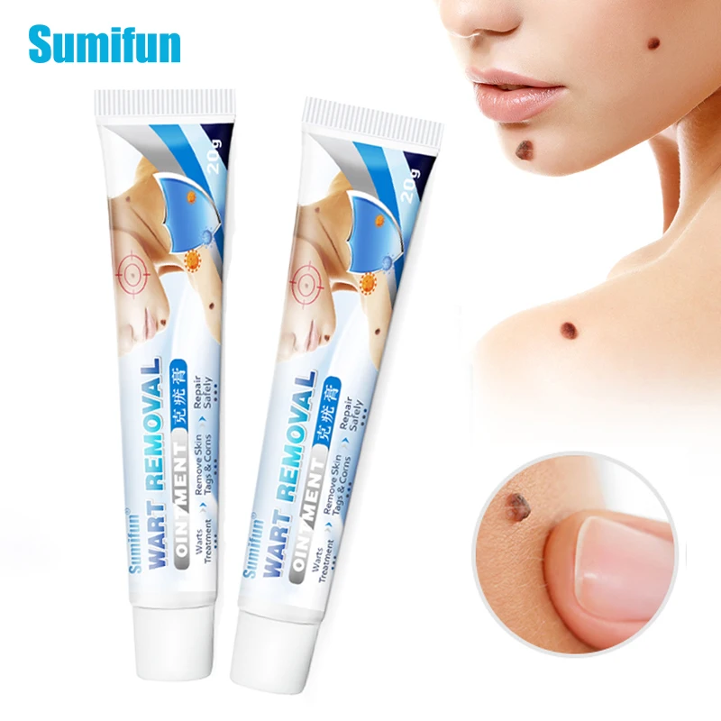 

2pcs Sumifun Wart Treatment Cream Warts Remover Antibacterial Ointment Skin Tag Remover Herbal Extract Foot Corn Plaster P1210