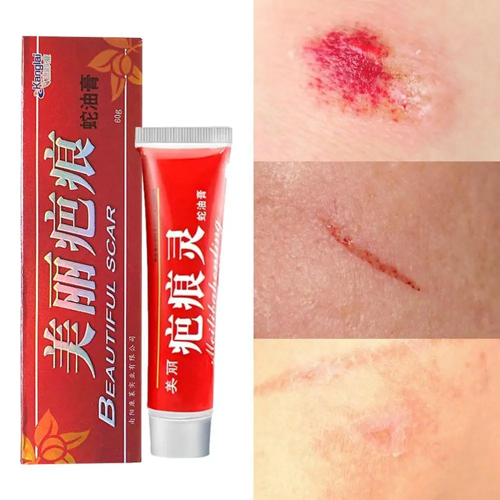 

Scar Removal Cream Acne Scars Gel Stretch Marks Surgical Acne Repair Spots Corrector Care For Body Burn Scar Pigmentation 6 P6J9
