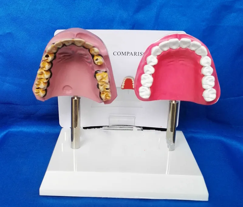 Модель зуба для кормления медицинская модель ухода за зубами обучения курению