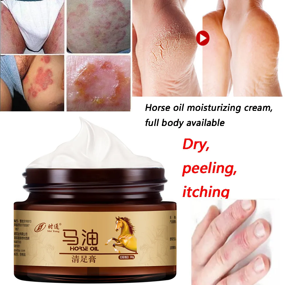 Highly Concentrated Moisturizing Agent Cracking Cream For Rough Dry And Cracked Heel Skin Anti-heel | Красота и здоровье