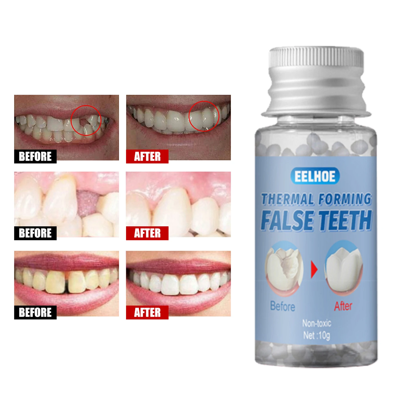 1 бутылка термальных фитингов зубные виниры выдвижной Временный набор для