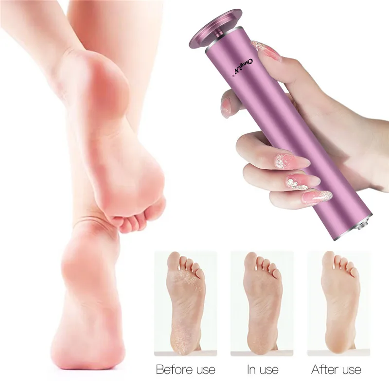 

CkeyiN Electric Foot File Vacuum Callus Remover Rechargeable Dead Skin Remover Wireless With Sandpaper Pedicure Tools Skin Care