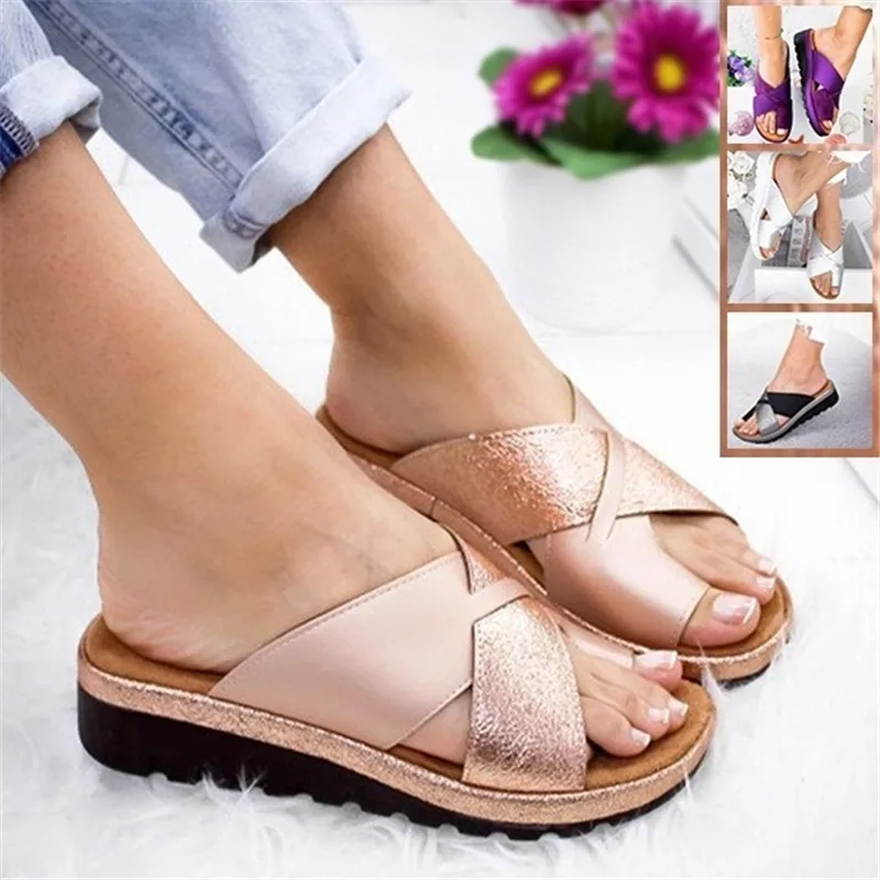 

2021 Women Artificial PU Shoes Slippers Orthopedic Bunion Corrector Comfy Platform Wedge Ladies Casual Big Toe Correction Sandal