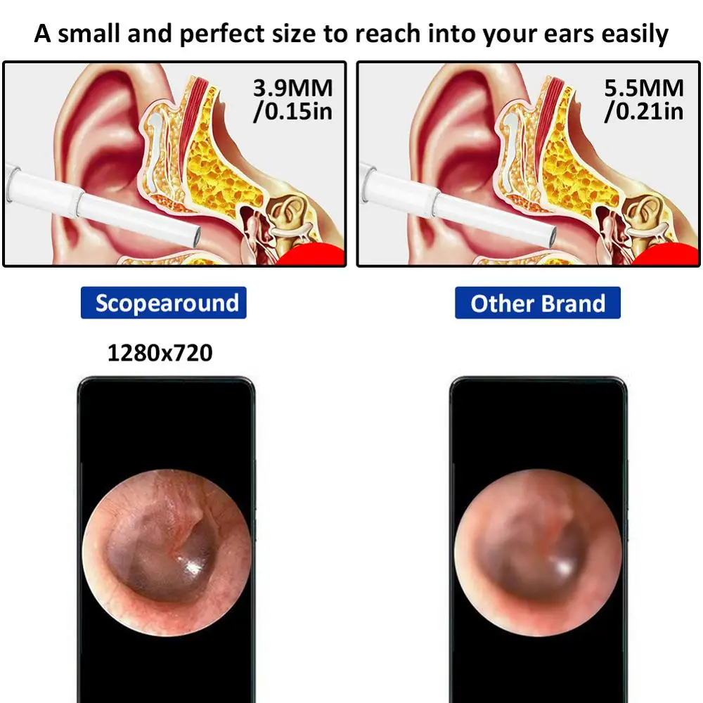 Модернизированная usb-камера Otoscope с цифровым отоскоп ушной камерой для очистки