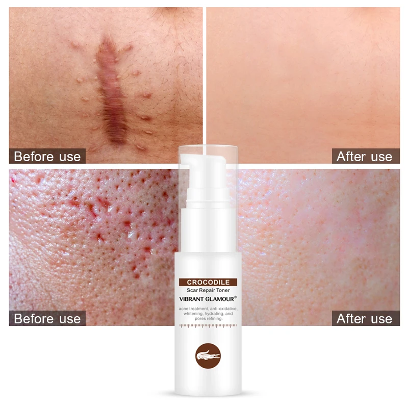 Яркий гламурный Тоник для лица крокодила восстанавливающий шрам сыворотка