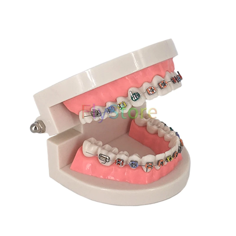 1 шт. Стоматологическая Ортодонтическая модель зуба с Орто-металлическим