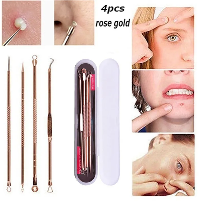 4 шт. от акне и черных точек комедонов черным пятнышком Экстрактор для чистки пор