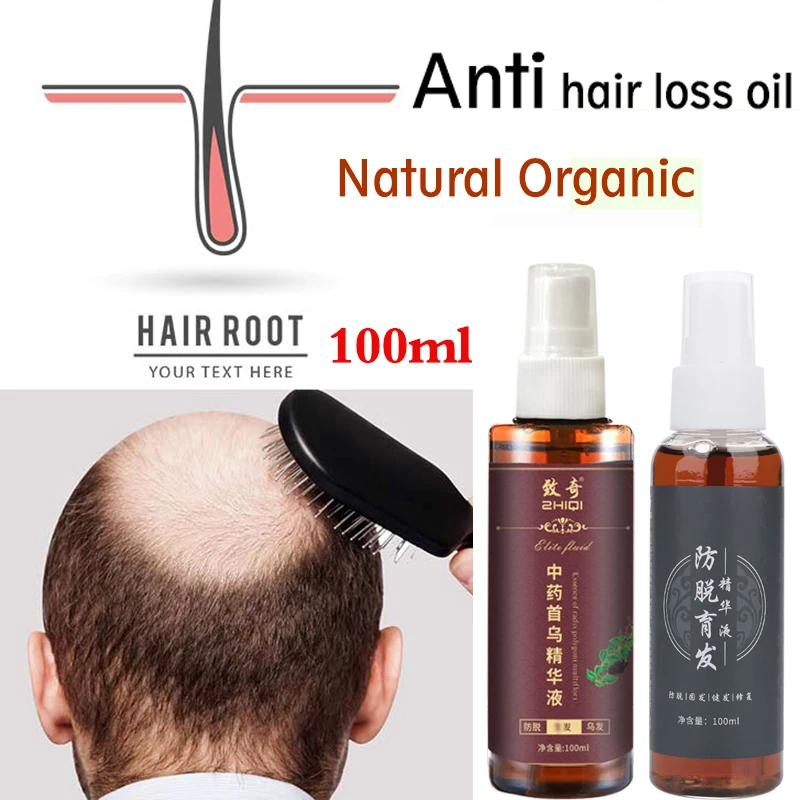 

100ml Natural Hair Growth Essence Spray 3PCS Nourish Hair Roots Anti Hair Loss Strengthen Soothing Scalp Treatment Essential Oil