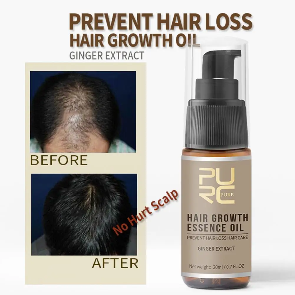 

PURC Hair Growth Oil Fast Hair Growth Products Scalp Treatments Prevent Hair Loss Thinning Beauty Hair Care for Men Women 20ml