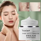 Yoxier крем для удаления темных точек, корректор темных пятен, выцветает, пятна для беременных, угрей, пигментация, отбеливание, уход за кожей