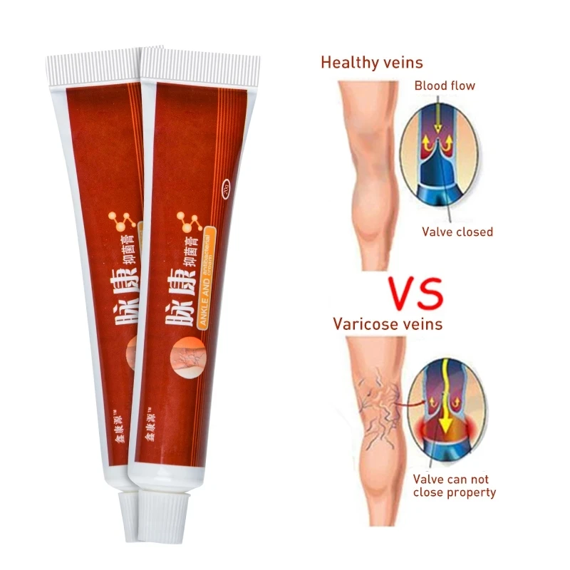 

20g Varicose Veins Treatment Cream For Vasculitis Phlebitis Blood Vessel Rotten Legs Angiitis Ointment Medical Plaster
