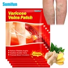 30 шт., пластырь от варикозного расширения вен Sumifun, васкулит, флебит, паук, крем для удаления варикозного ангиита, из трав, медицинская пластырь K06201
