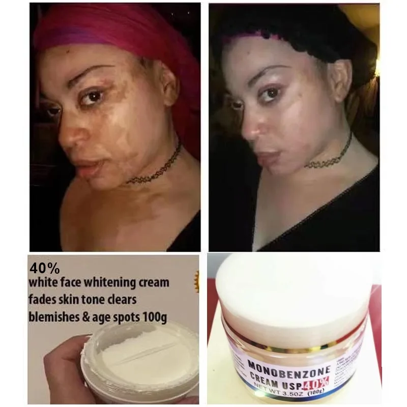

Отбеливающий Обесцвечивающий крем Monobenzone 40% / 20% удаляет пятна, восстанавливает блески, отбеливает меланин 100 г