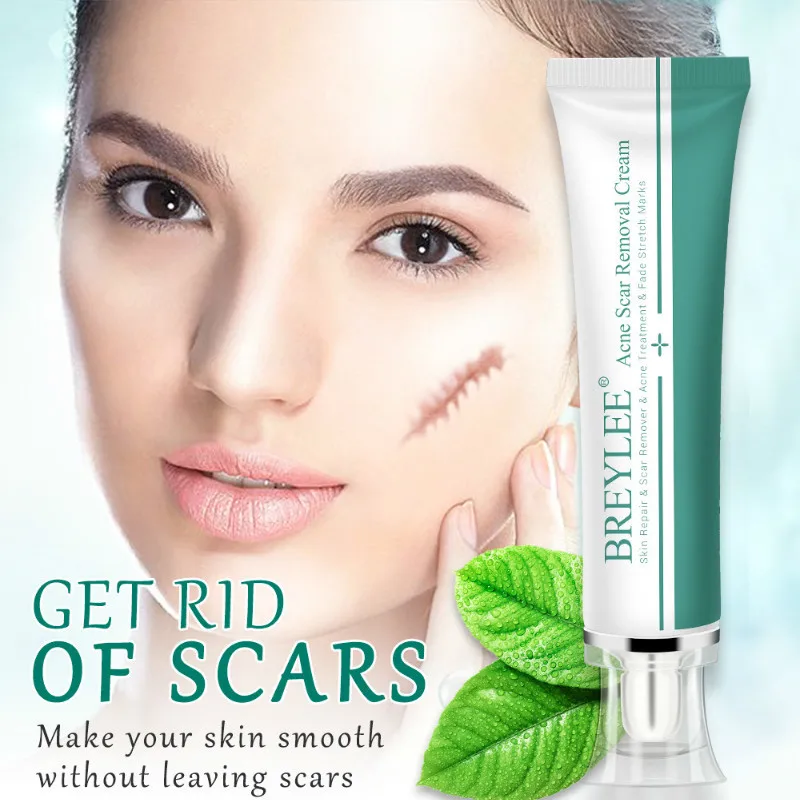 

30g Acne Treatment Blackhead Remova Anti Acne Cream Oil Control Shrink Pores Acne Scar Remove Face Care Whitening TSLM1