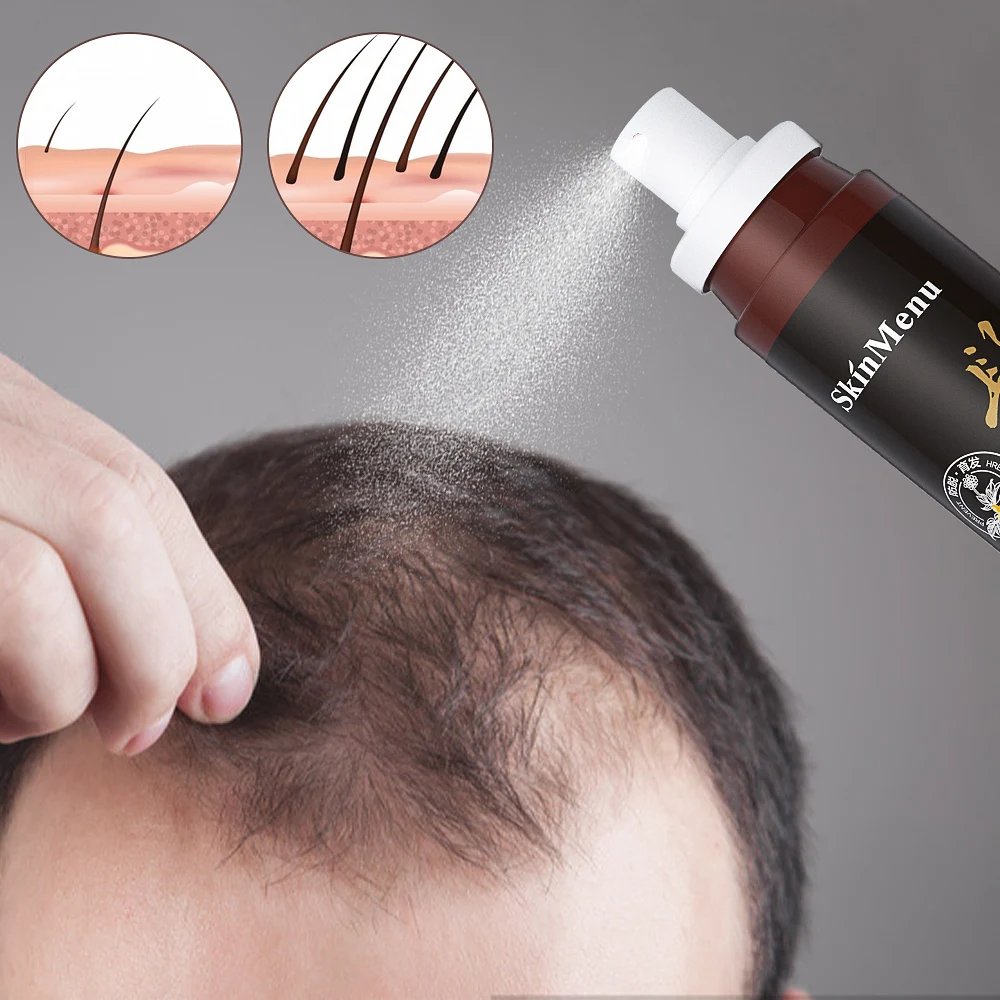 

Polygonum Multiflorum Hair Nourishing Lotion To Increase The Density Of Hair And Slow Down The Growth Of Hair Spray 100ml