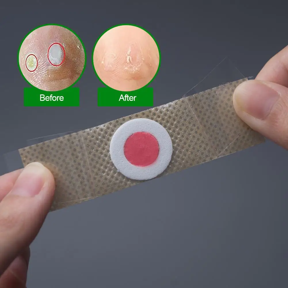 XY Fancy 42 шт. пластырь для удаления мозолей старый кокон шип ног кукурузная паста