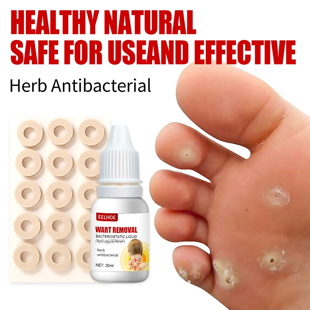 

30ml Wart Treatment Liquid Skin Tag Wart Removal Cream Natural Extract Armpit Neck Moles Remover Warts Liquid From Skin Tags