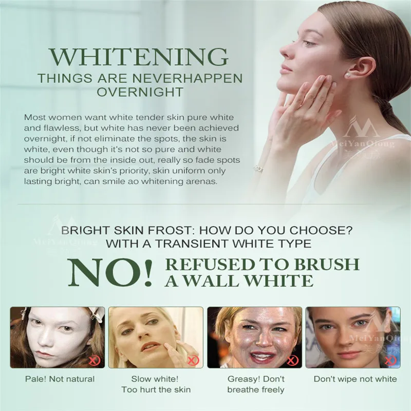 2019 Новый сильное влияние мощный крем для отбеливания веснушек удаления мелазмы