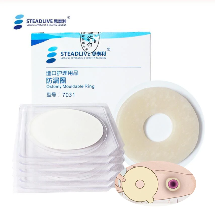 10 шт. кольцо паста для стомии растягивающаяся основа предотвращения утечки