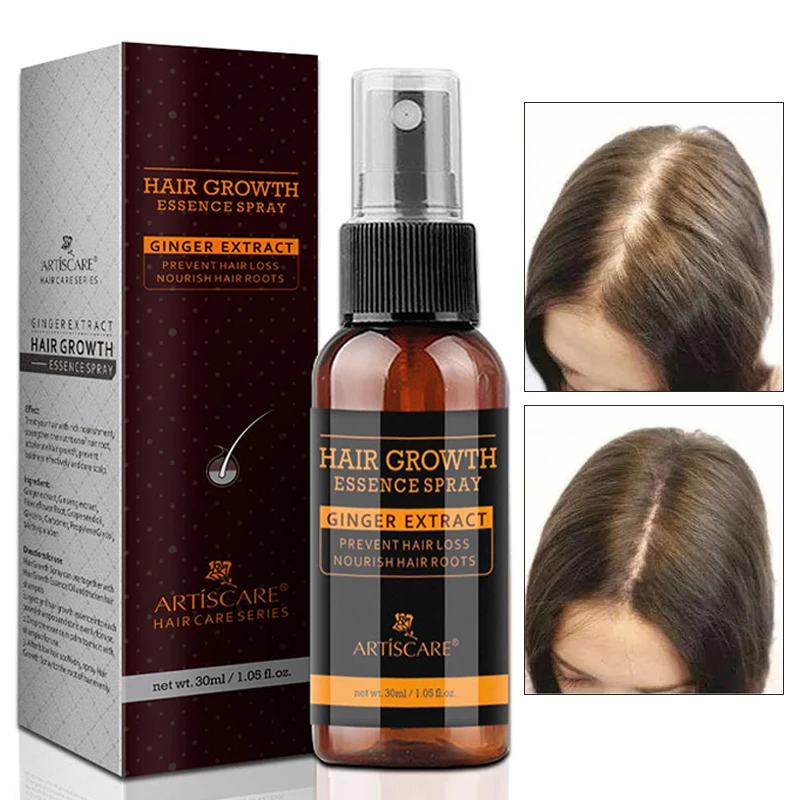 

Hair Growth Spray Serum Oil Control Dense Fast Growing Hair Oil Prevent Hair Loss Thinning Healthy Nourish Scalp Treatment 30ml