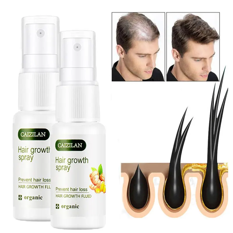 Имбирная сыворотка-спрей для роста волос 2 шт. | Красота и - Цена: 476.03