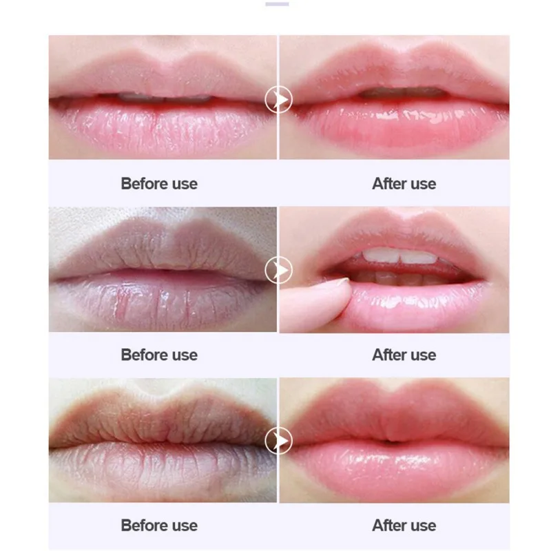 New Lip Mask Skin Care Crystal Collagen Powerful Moisturizing Pads for Anti-aging Plumper Pump Essentials Lips |