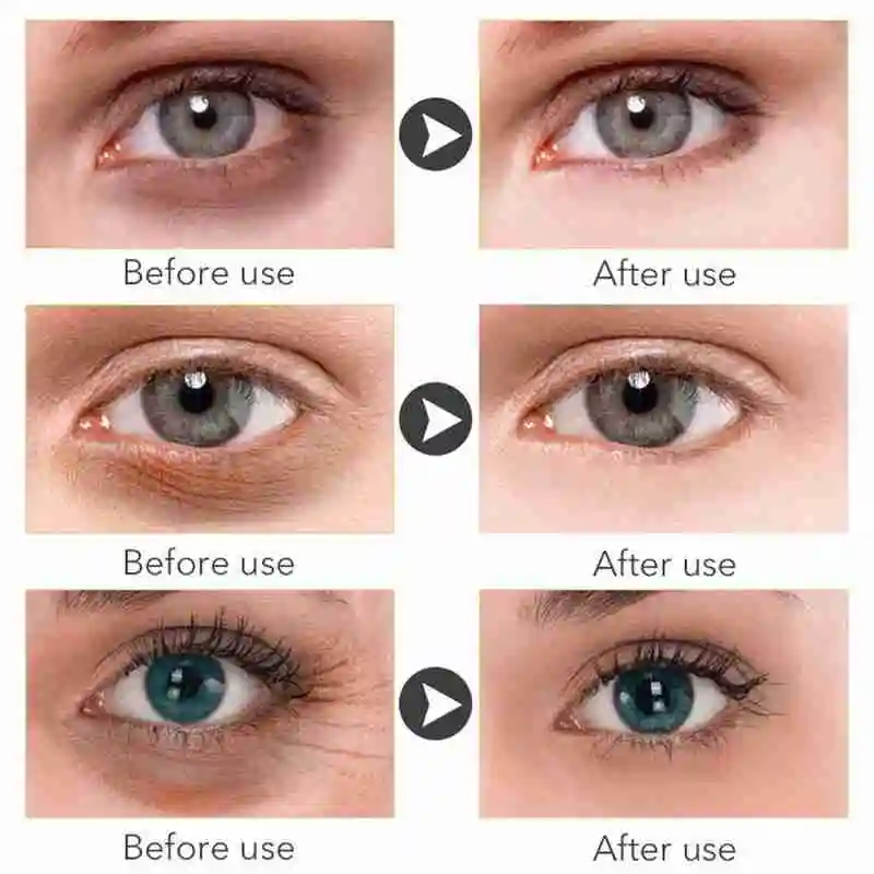 

Instant Remove Eye Bags Cream Retinol Cream Anti Puffiness Gel Dark Circles Delays Aging Fades Wrinkles Firming Brighten Skin