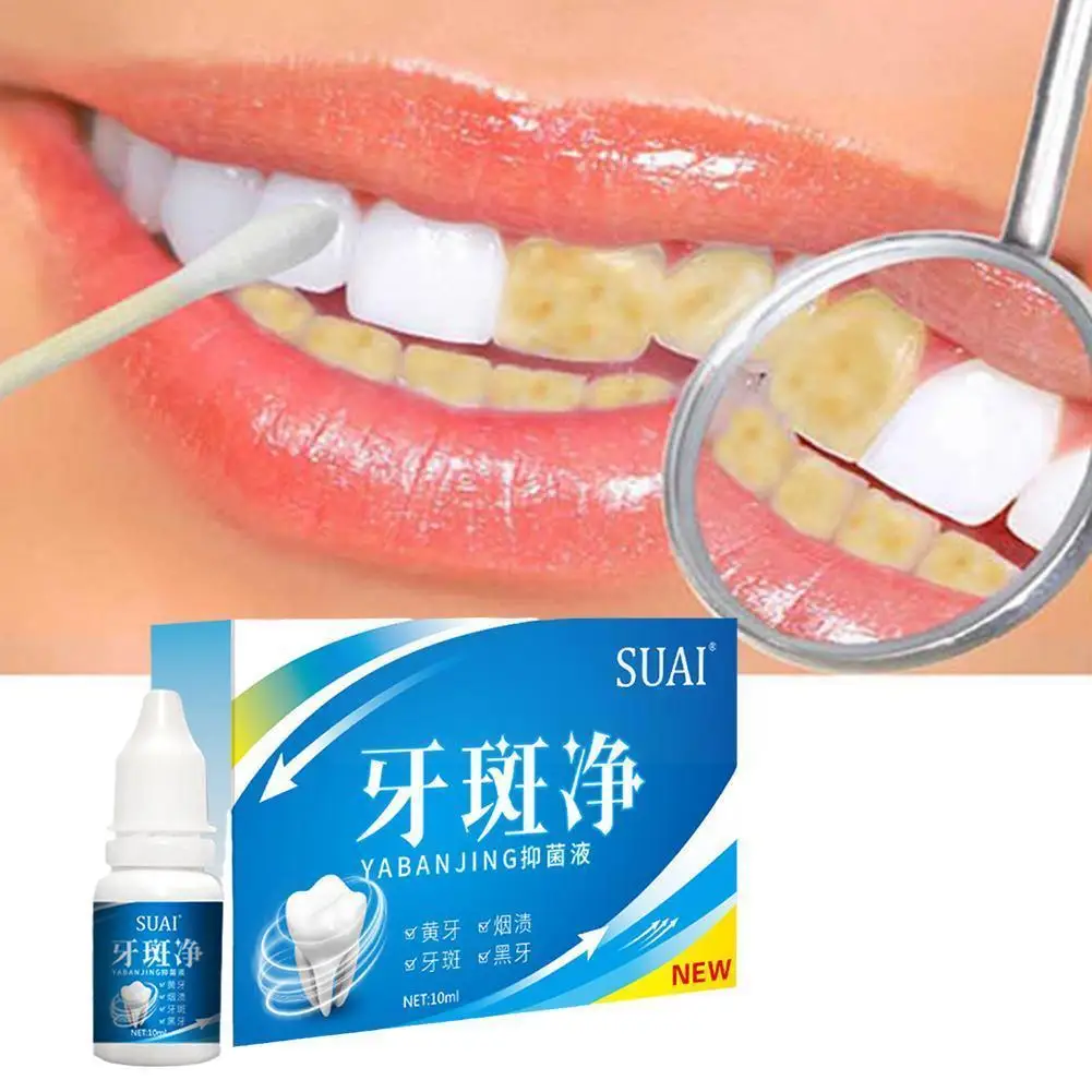 

Прибор для отбеливания зубов, средство для чистки и отбеливания зубов, инструменты для удаления зубных пятен, зубной налет V5r4