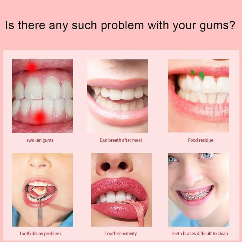 

Oral Irrigator USB Rechargeable Water Flosser Portable Water Teeth Water Tank Cleaner Dental 170ML Jet Waterproof J3E1