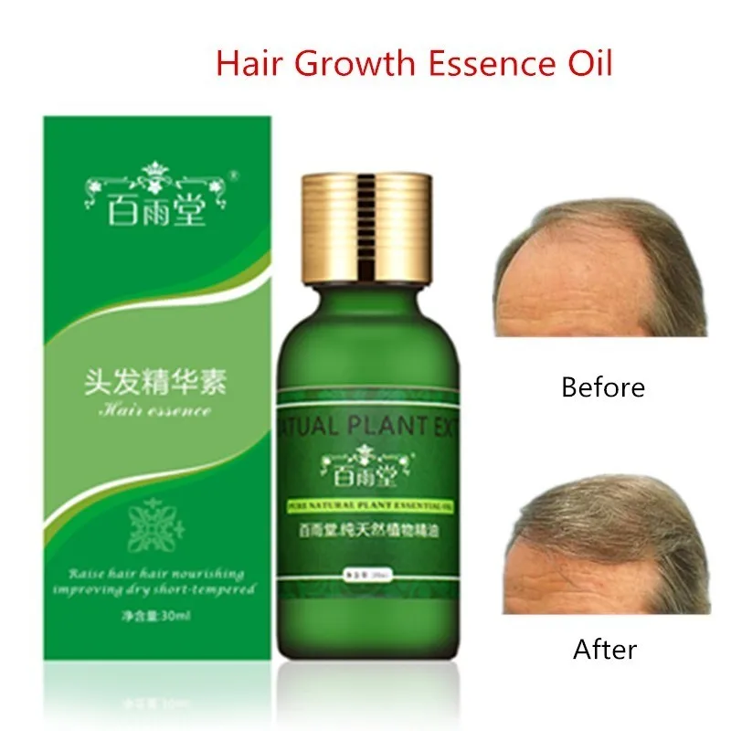 Эфирные масла для роста волос 30 мл | Красота и здоровье