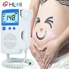 Детские допплер 3,0 МГц ультразвуковой датчик сердцебиения плода бытовой Портативный сонар Doppler для беременных без излучения стетоскоп для беременных женщин для дома доплер для беременных фетальный допплер видеоняня