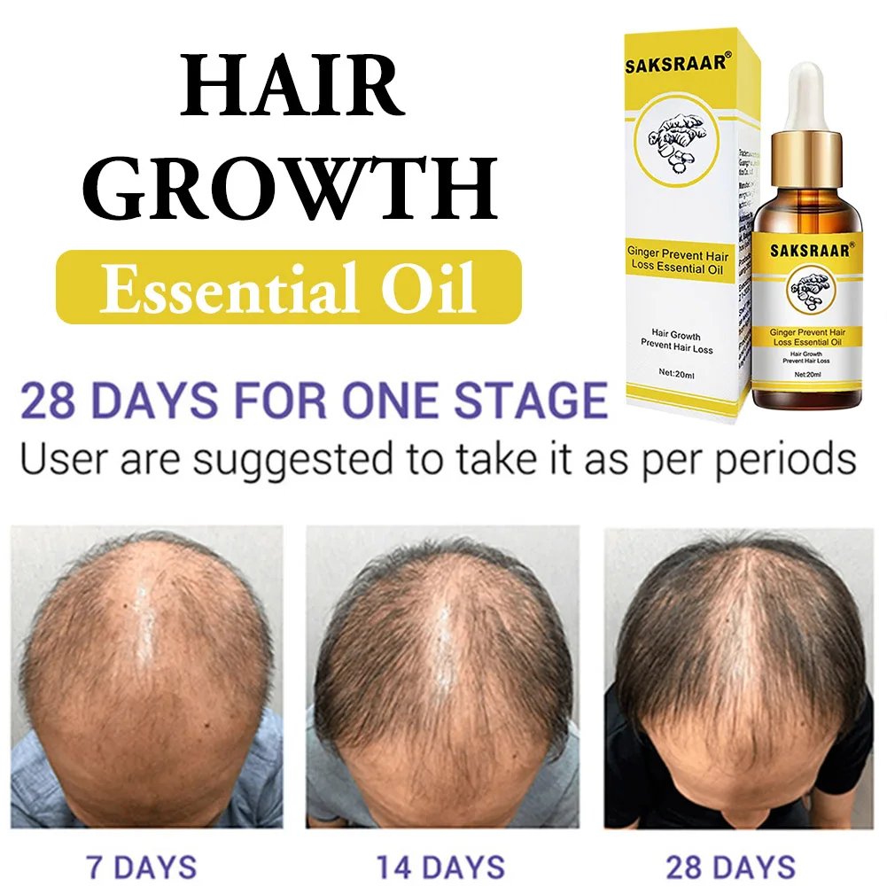 

Ginger Hair Care Growth Essence Nutrient Solution To Prevent Hair Loss Plant Hair Nourishing Hair Care Essential Oil Dense Hair