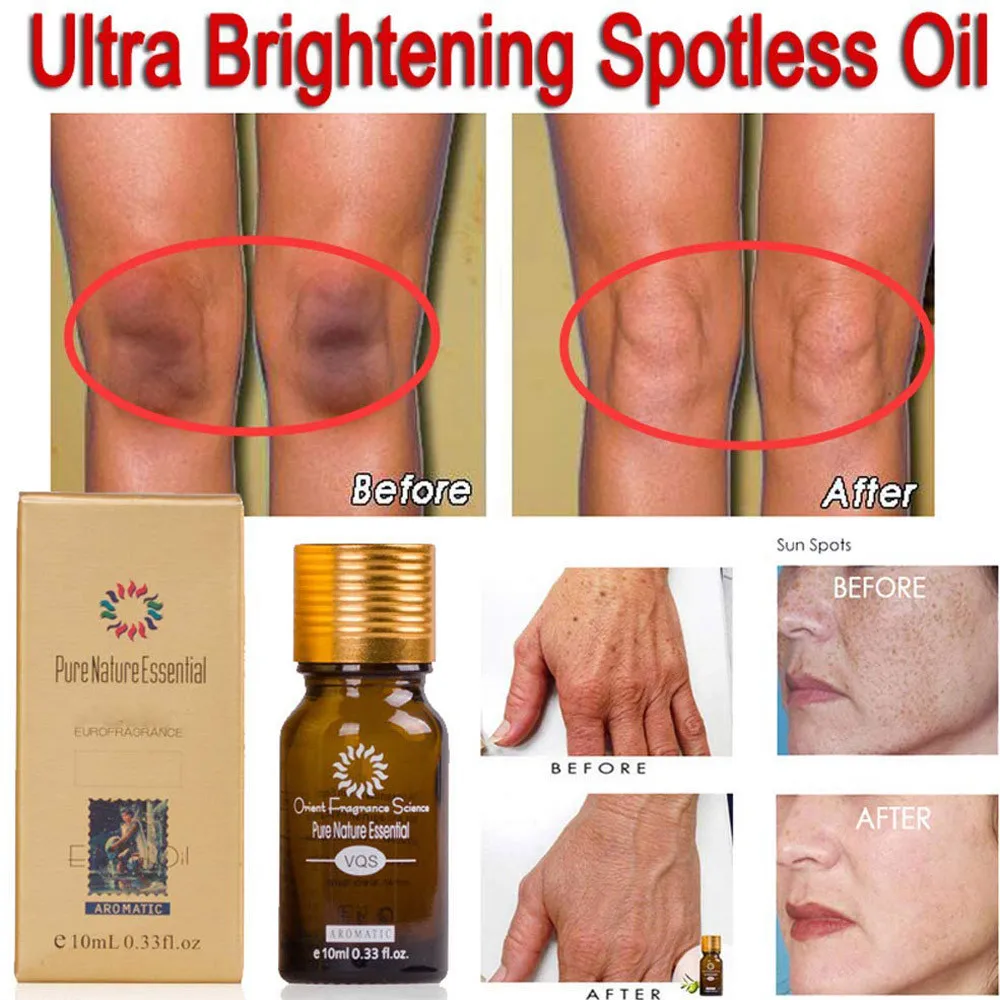 

10ML 2PCS Pure Natural Essential Ultra Brightening Spotless Oil Dark Spots Fade Away Age Spots Hyper Pigmentation Essential Oil