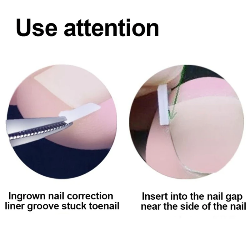 

Ingrown Toenail Lifter Nail Clipper Corrector Liner Professional Grade Corrector Straightener Strips Nail Cleaner Tool