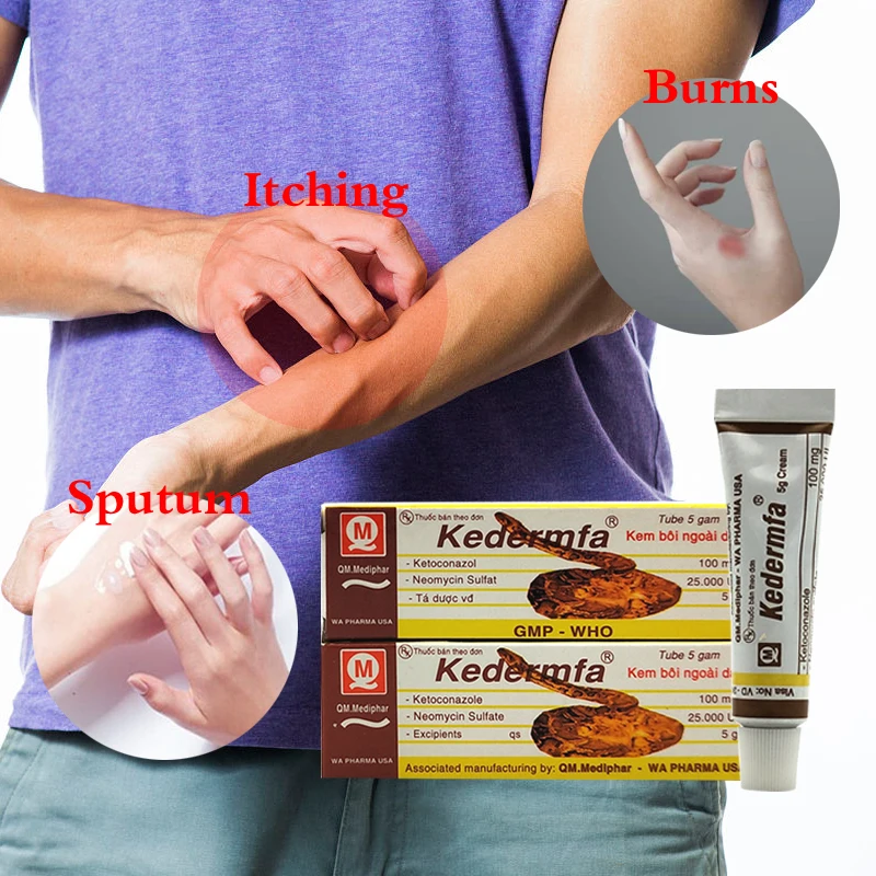 

1pcs Profession Snake Oil itching ointment Remove Scar cream Striae Gravidarum Pigmentation Acne burn cream herbal plaster